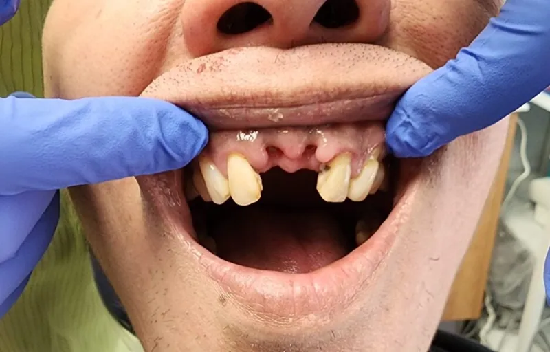 Teeth before treatment