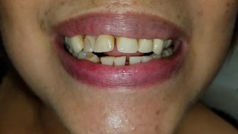 Teeth after treatment