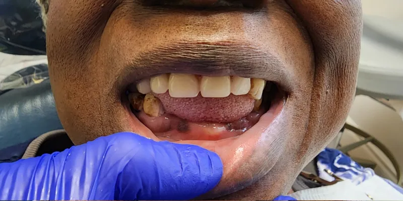 Teeth before treatment